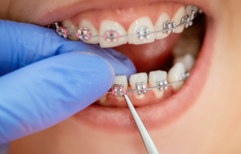 Is It Too Late For Dental Plastic Surgery At The Age Of 20?